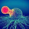 Büyük B Hücreli Lenfoma İkinci Basamak Tedavisi için Breyanzi FDA Onayı Aldı