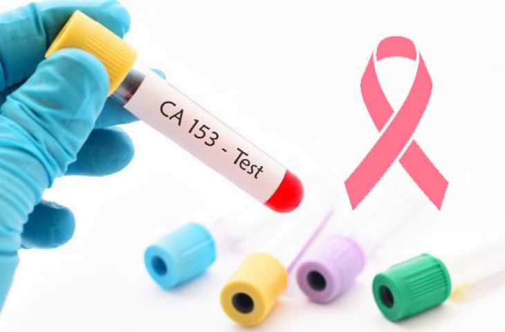 CA 15-3 Testi Nedir? Meme Kanseri için Önemi