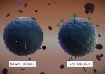 CAR T hücre immünoterapisinin organ kanserlerinde kullanımında önemli gelişmeler