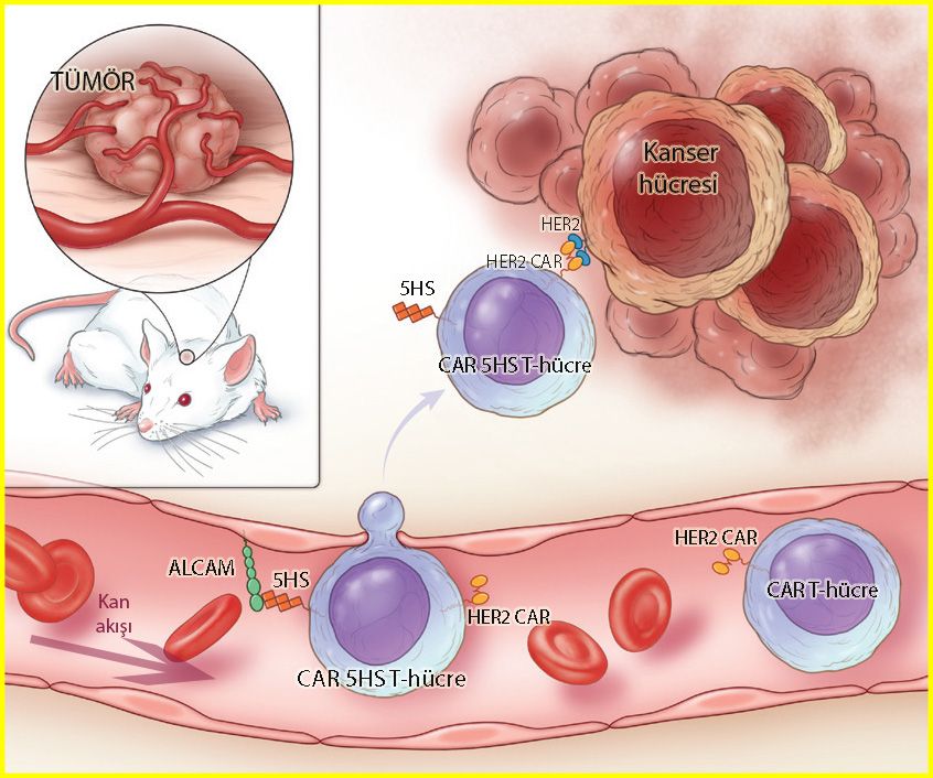 car t solid kanser alcam 5hs her2 dual nejm glioblastom