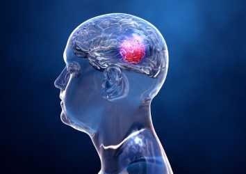 Çocukluk Çağı Beyin Tümörleri için Dabrafenib-Trametinib Kombinasyonu FDA Onayı Aldı