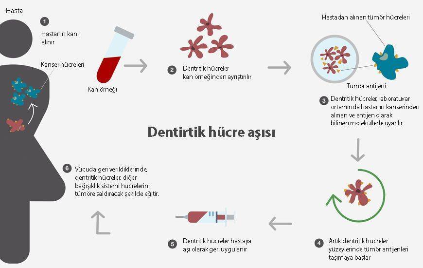 dentritik hücre kanser aşısı nedir nasıl hazırlanır