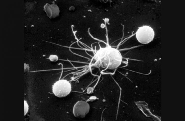Dendritik hücreler ve dentritik hücre kanser aşısı