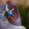 Dikkat Çeken ve Ödül Alan Güncel Akciğer Kanseri Araştırmaları