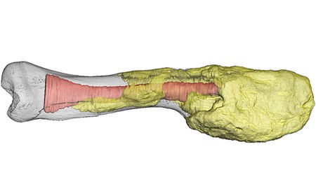 dinozorda teşhis edilen malign bir tümörün ilk örneği