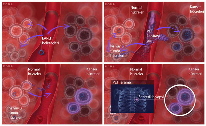 earli sentetik biyopsi kanser erken tani yeni yontem pet tarama