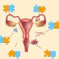 Endometriozis ve Over (Yumurtalık) Kanseri Arasındaki Bağlantı Nedir?
