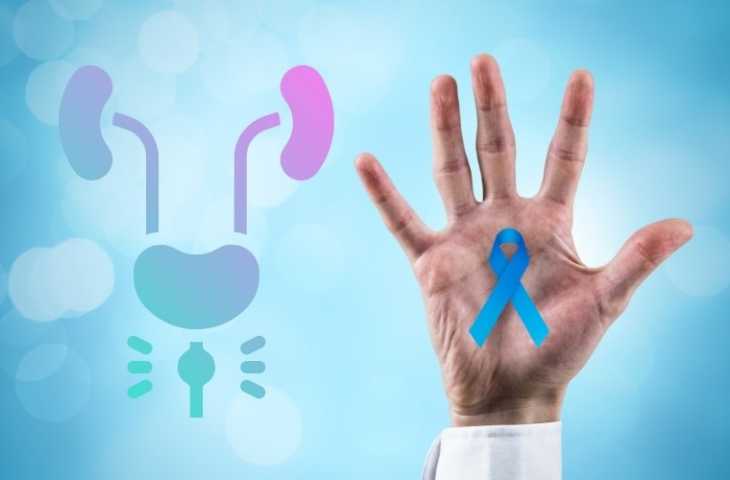 Erken Evre Prostat Kanserinde Tedavi mi Aktif Gözlem mi?