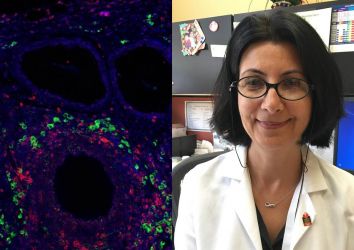 Türk Profesör Esma Yolcu, kanser gelişimini önleme potansiyeline sahip yeni bir immunoterapi molekülü keşfetti