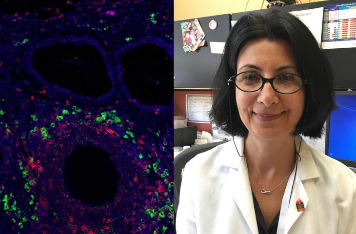 Türk Profesör Esma Yolcu, kanser gelişimini önleme potansiyeline sahip yeni bir immunoterapi molekülü keşfetti