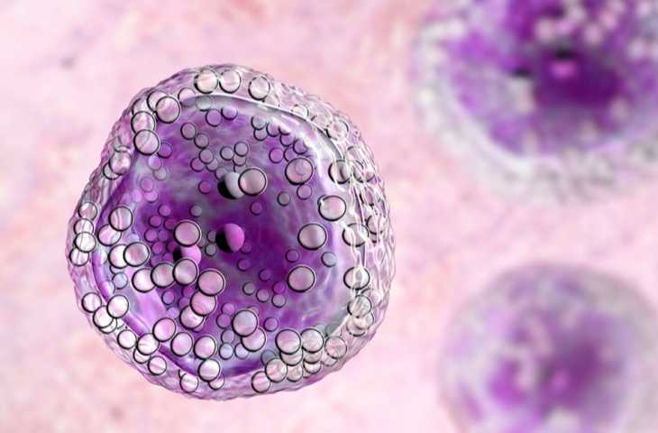 Foliküler Lenfomada Sınıfının İlk Bispesifik Antikoru Mosunetuzumab-axgb FDA Onayı Aldı