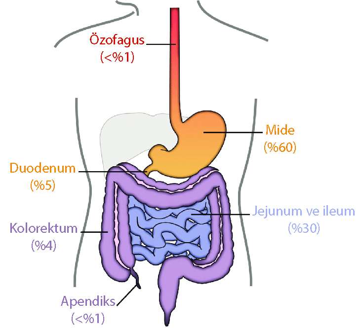 gastrointestinal stromal tümörlerin anatomik lokalizasyon