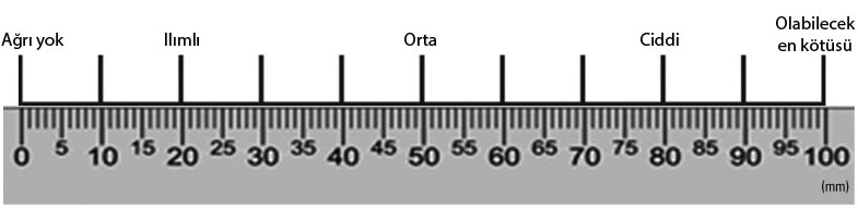 görsel analog skala 0 mm ağrı yok 100 mm en şiddetli ağrı