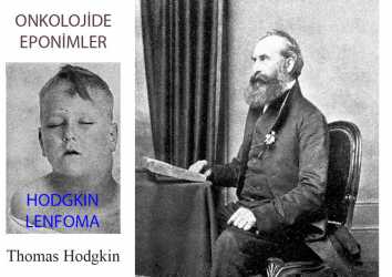 Hodgkin Lenfoma Nedir? Adı Nereden Gelmektedir?