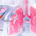 İlk Kez HER2 Mutant Akciğer Kanserinde Bir İlaç FDA Onayı Aldı: Trastuzumab Deruxtecan