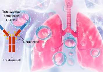 İlk Kez HER2 Mutant Akciğer Kanserinde Bir İlaç FDA Onayı Aldı: Trastuzumab Deruxtecan