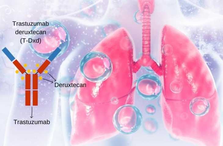 İlk Kez HER2 Mutant Akciğer Kanserinde Bir İlaç FDA Onayı Aldı: Trastuzumab Deruxtecan