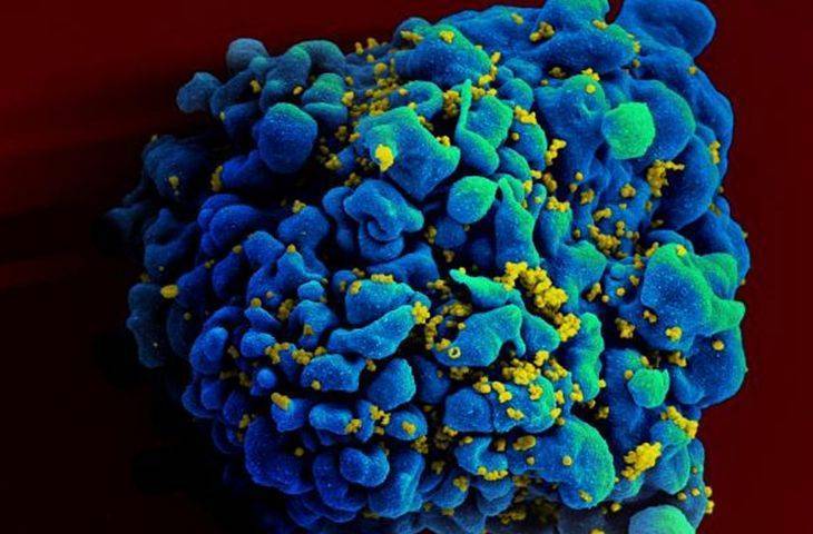 İmmünoterapi ilacı nivolumab, AİDS tedavisi için yeni bir kapı araladı