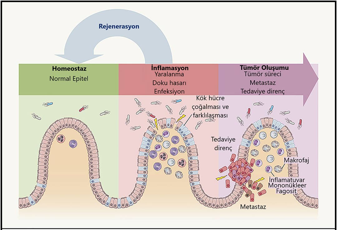 inflamasyon ve tumor olusumu