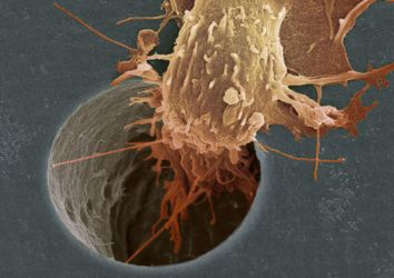 Kanser hücresinin hareketini engelleyerek metastazı önleyen yeni bir tedavi stratejisi