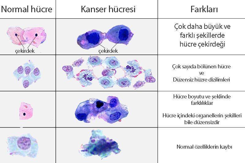 kanser ve normal hücre farkı onkolojik terimler