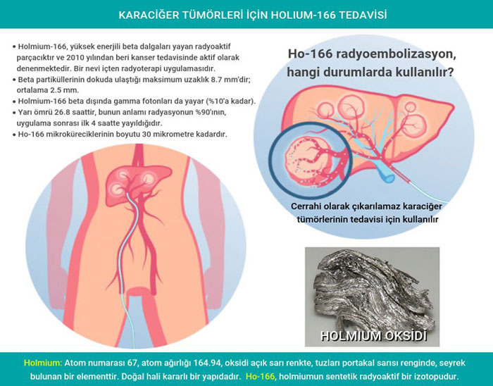 karaciger tumorleri icin holium 166 tedavi