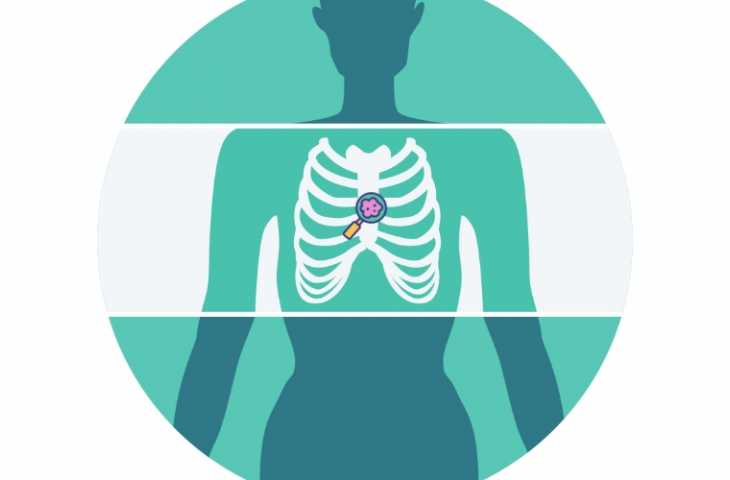 Kemik Metastazlarına Koruyucu Radyoterapinin Sağkalımı Uzatması Büyük Yankı Uyandırdı