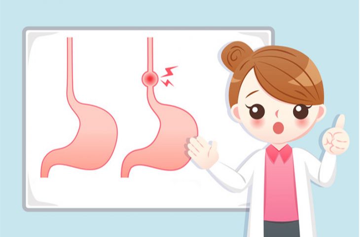 Özofagus (yemek borusu) kanseri ikinci basamak tedavisinde immünoterapi Pembrolizumab