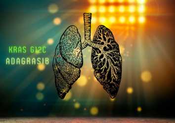 KRAS G12C Mutasyonu Pozitif Akciğer Kanseri için Adagrasib FDA Onayı Aldı