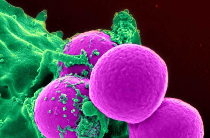 Küçük Hücreli Akciğer Kanseri İçin İki Katına Çıkma Süresi (The Doubling Time) Nedir?