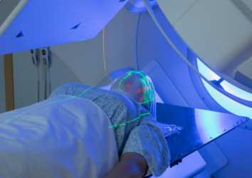 Küçük Hücreli Akciğer Kanserinde Tüm Beyin Radyoterapisine Karşı Noktasal Işınlama