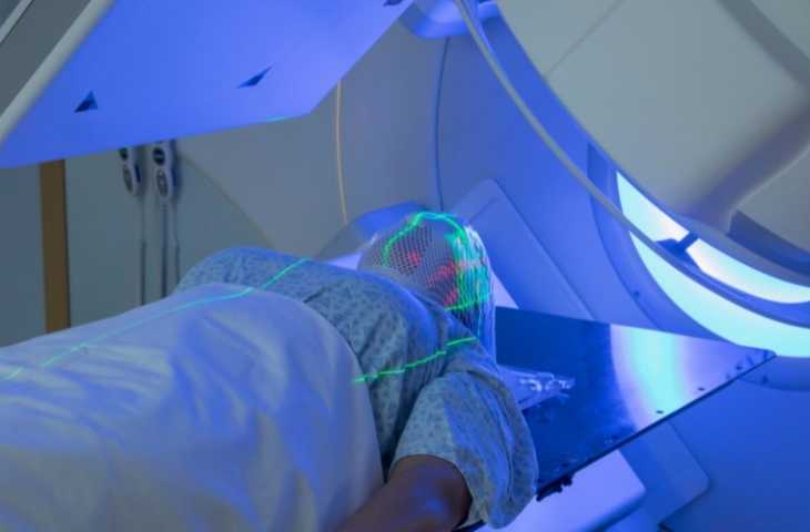 Küçük Hücreli Akciğer Kanserinde Tüm Beyin Radyoterapisine Karşı Noktasal Işınlama