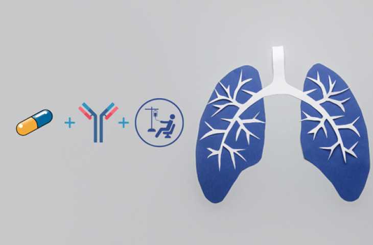 Küçük Hücreli Akciğer Kanserinde Üçlü Kombinasyon – Şimdiye Kadar Alınan En İyi Sonuçlar