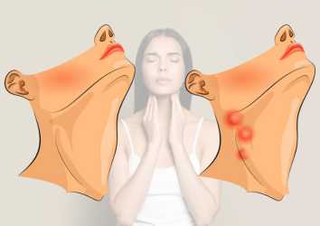 Lenfadenit Nedir? Belirtileri Nelerdir? Kanser midir?