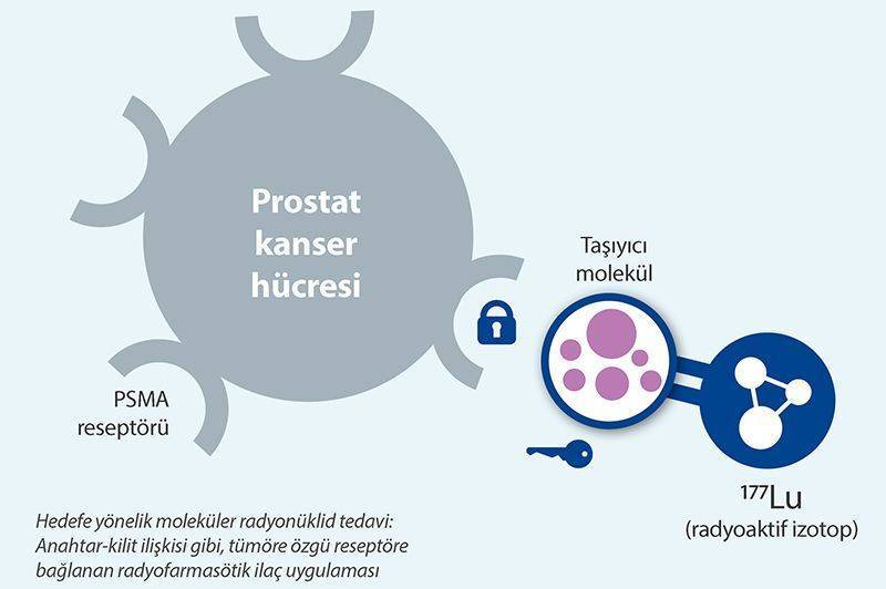 lutesyum tedavisi lu177 prostat kanseri nükleer tıp