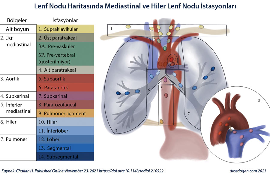 mediastinal lenf nodu haritasında mediastinal ve hiler lenf nodu istasyonlarını nelerdir