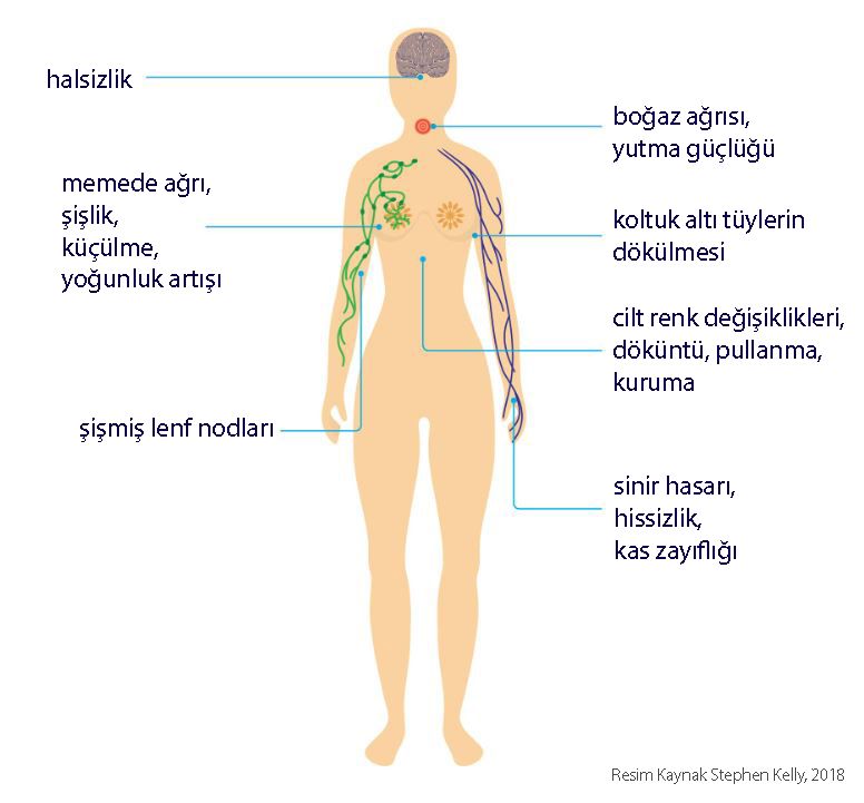 memede radyoterapinin yan etkileri nelerdir azaltmak icin ne yapilir prof dr mustafa ozdogan