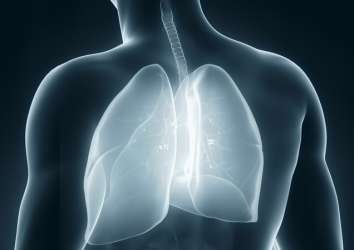 Plevral mezotelyoma (akciğer zarı kanseri) tedavisinde elektriksel akım tedavisi FDA onayı aldı