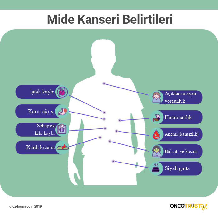 mide kanseri belirtileri