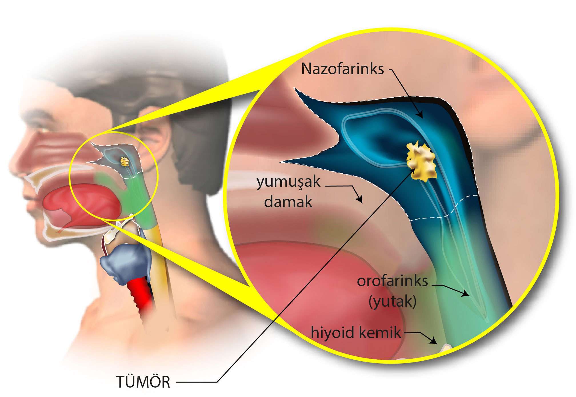 nazofarinks geniz bölgesinde bir tumor anatomi