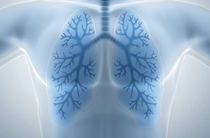 New Prognostic Markers in Patients With Lung Cancer Treated With Immunotherapy – NLR and PLR