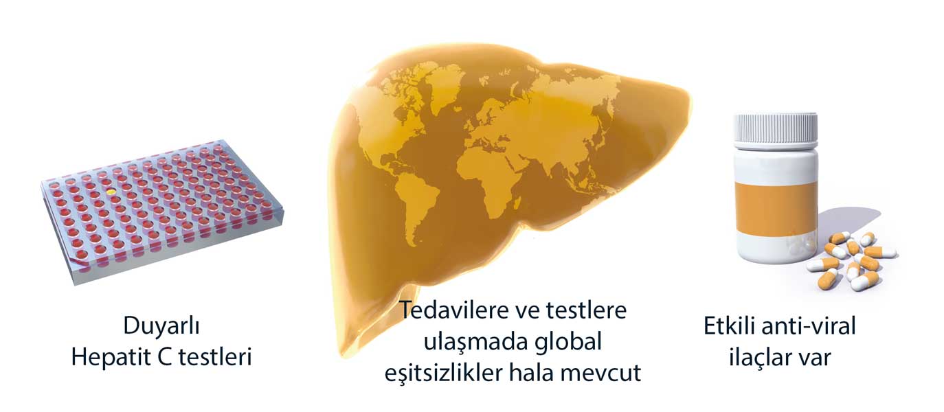 Nobel Tıp Ödülü 2020 Hepatit C keşfi tıbba etkileri