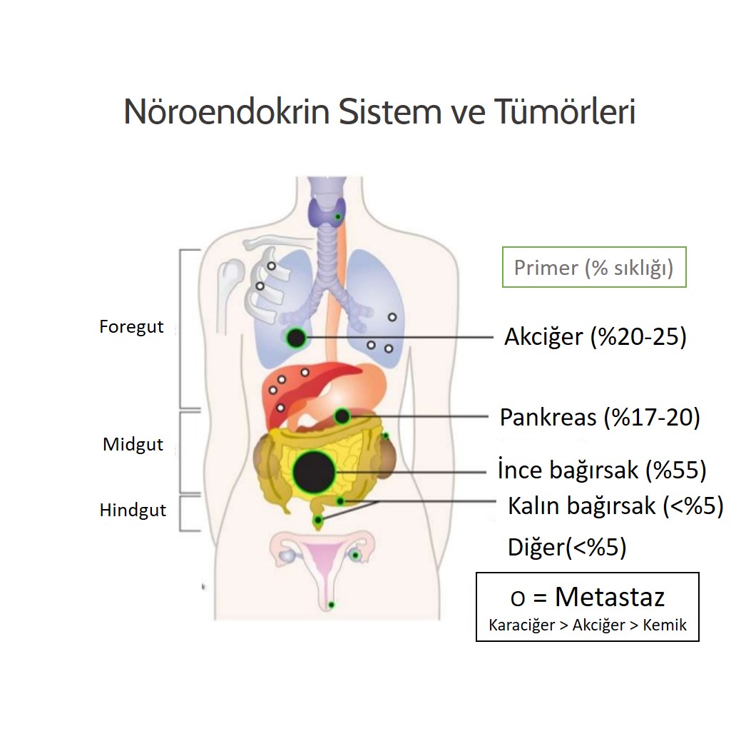 nöroendokrin tumorler hangileridir