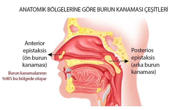 ön anterior ve arka posterior burun kanaması çeşitleri