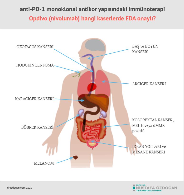 opdivo nivolumab hangi kanser turlerinde fda onayi aldi