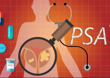 Orta Yaşta Bakılan Bazal PSA Değeri, Prostat Kanseri Erken Tanısında Kullanılabilir mi?