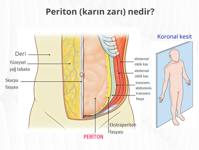 periton karin zari koronal kesit