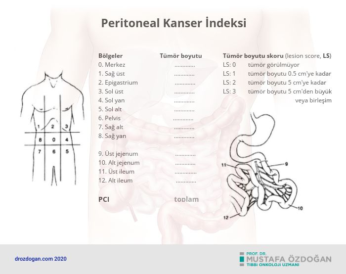 peritoneal kanser indeksi nedir