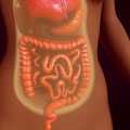 Peritoneal mezotelyoma nedir? Peritonektomi, sitoredüktif cerrahi ve HİPEK