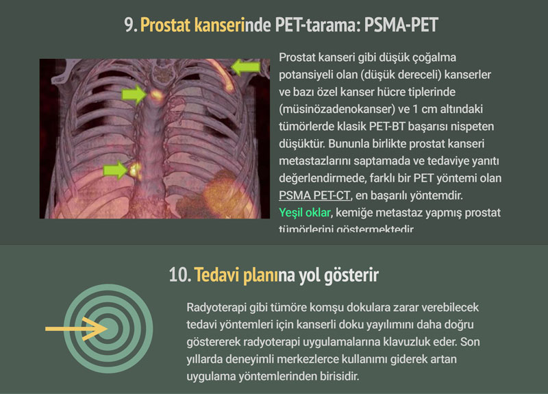 pet bt pozitron emisyon tomografisi nedir tarihcesi (5)